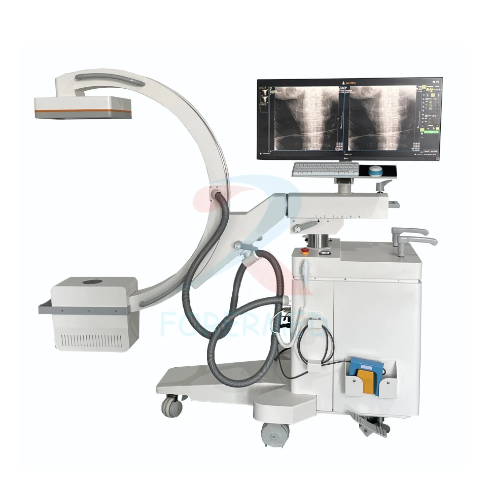 Mobile C Arm X Ray Machine best Mobile C Arm X Ray Machine best