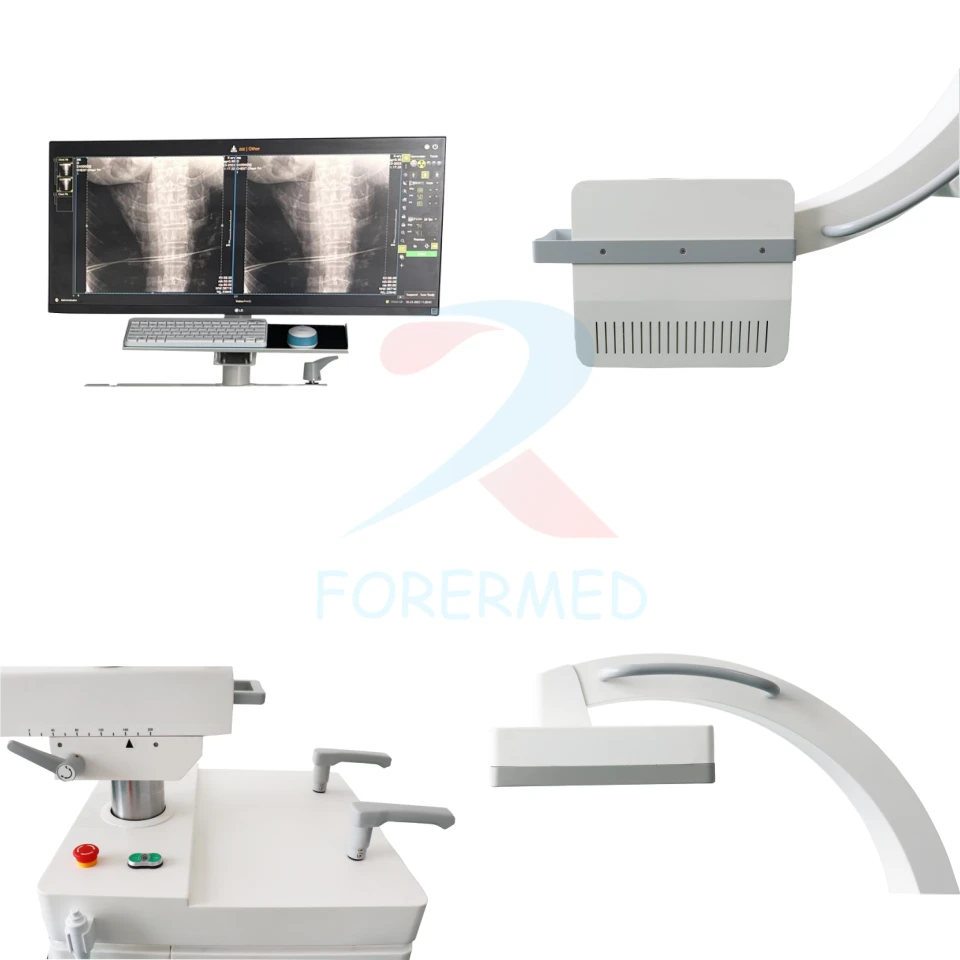 Mobile C Arm X Ray Machine high quality Mobile C Arm X Ray Machine high quality