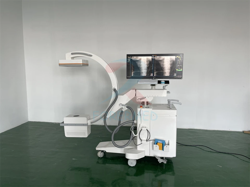 Mobile C arm X ray Machine Mobile C arm X ray Machine