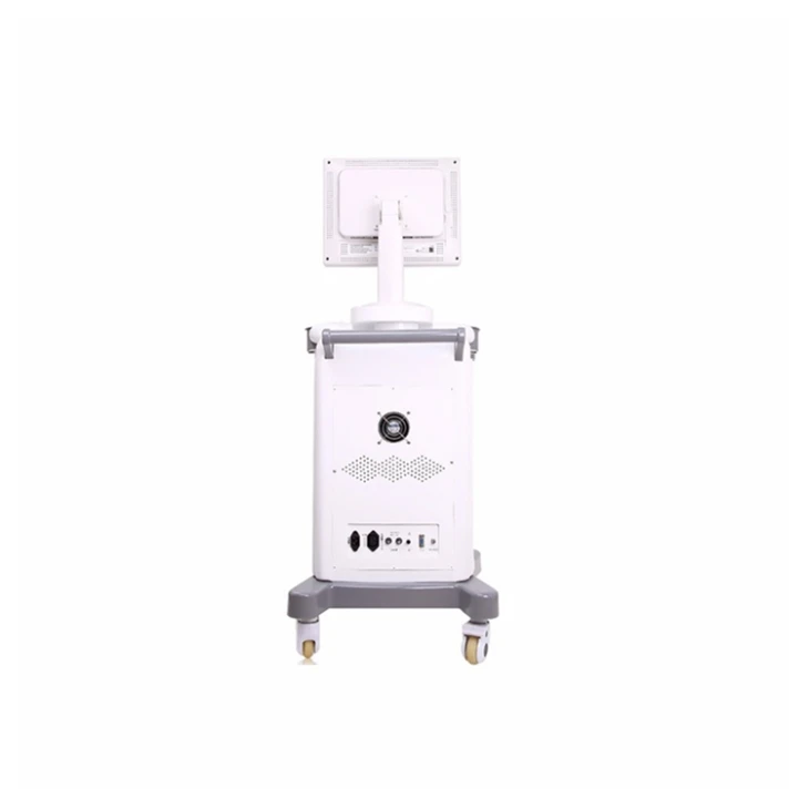 Digital Camera Ultrasound Diagnosis Equipment Digital Camera Ultrasound Diagnosis Equipment
