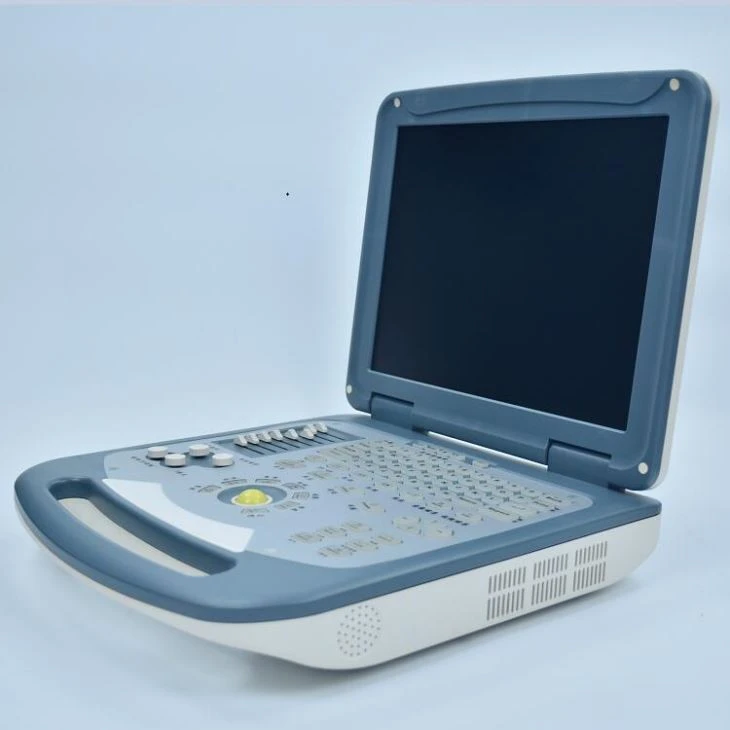 Laptop Ultrasound Scanner Laptop Ultrasound Scanner