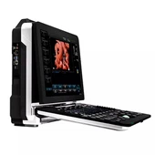 Karsti pārdodami piezīmjdatori slimnīcas medicīnas pārnēsājamais ultraskaņas 4D krāsu Doplera 15 collu LED ekrāns